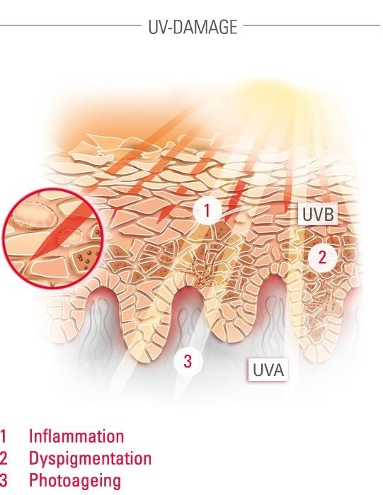 Tissue repair